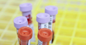 The Types of Chemical, Blood, and Breath Tests Used for Florida DUI Charges